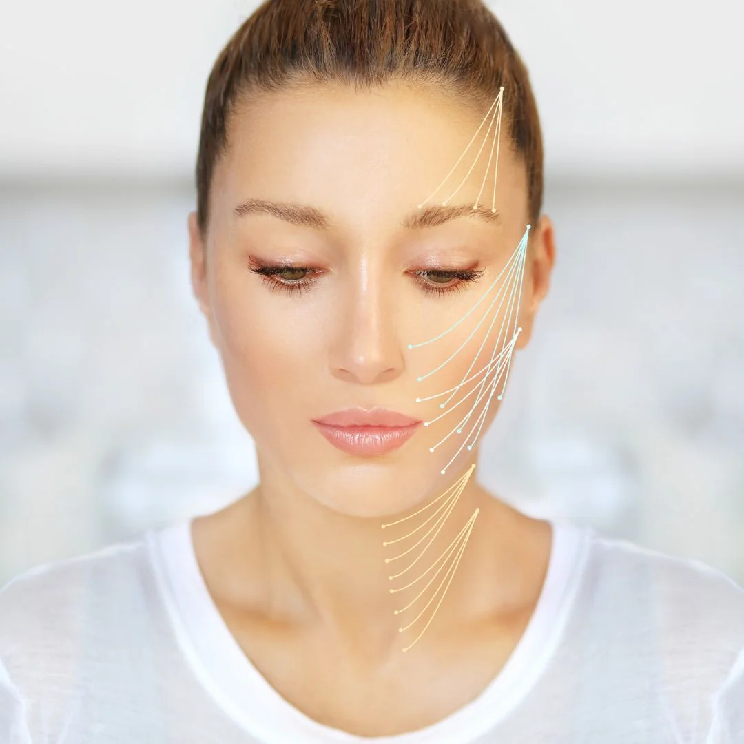 Evaluación facial para hilos de suspensión