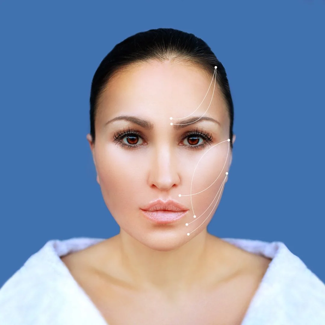 Valoración clínica para hilos de suspensión