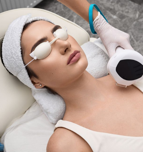 Indicaciones del tratamiento IPL