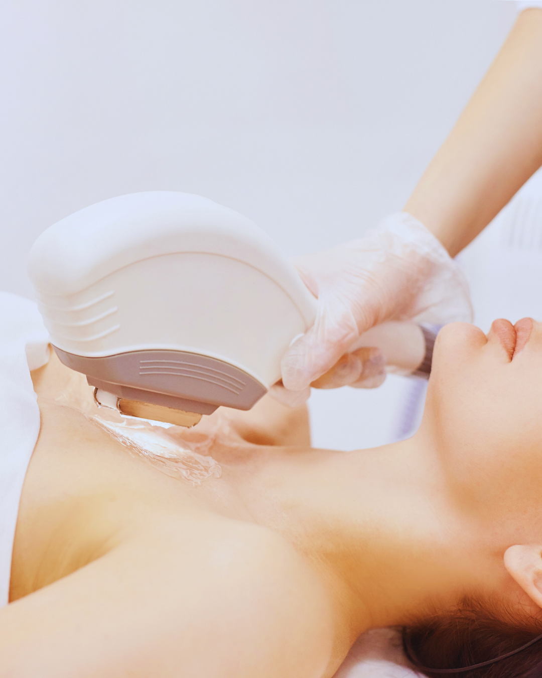 Procedimiento con IPL