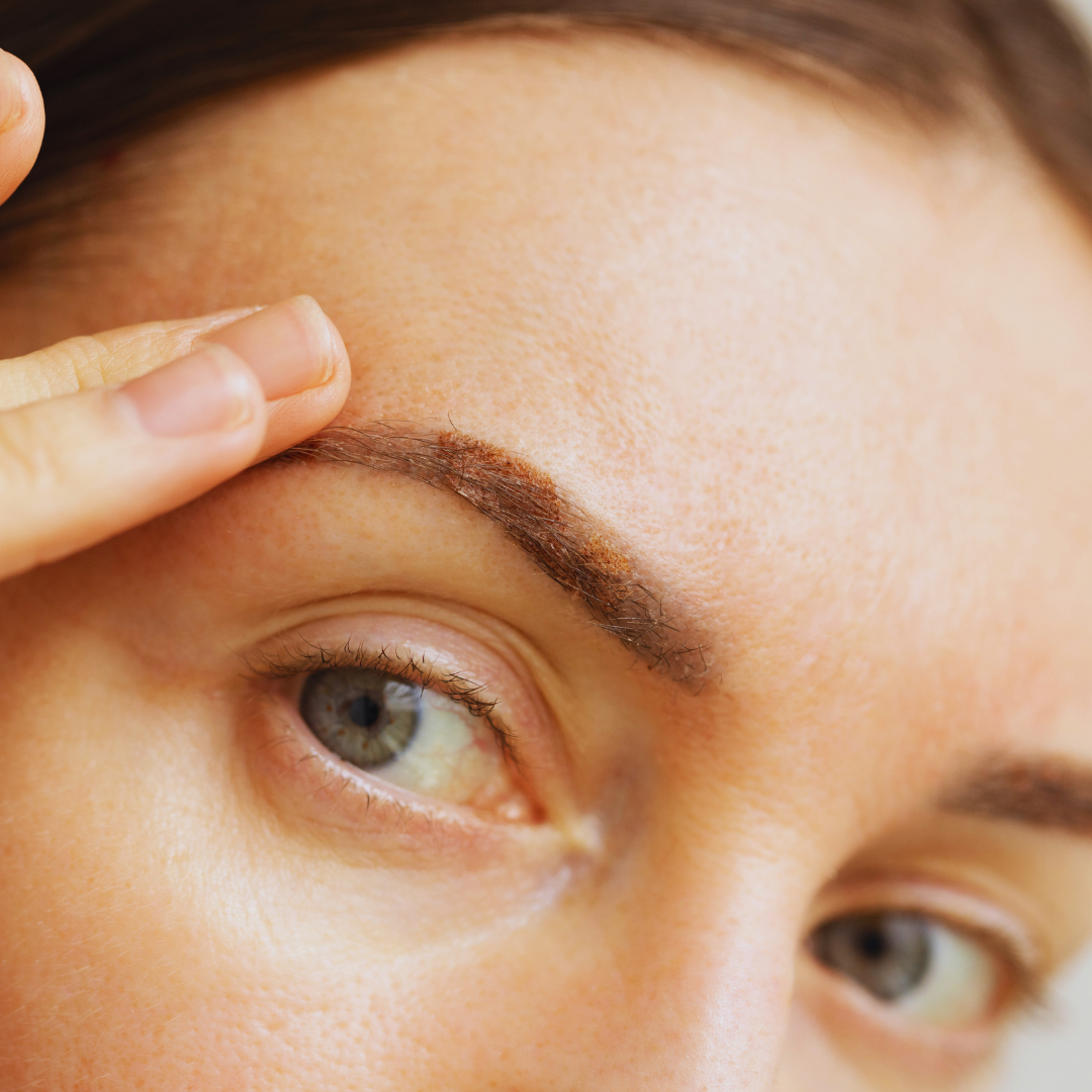 Detalle visual del peeling químico en consulta