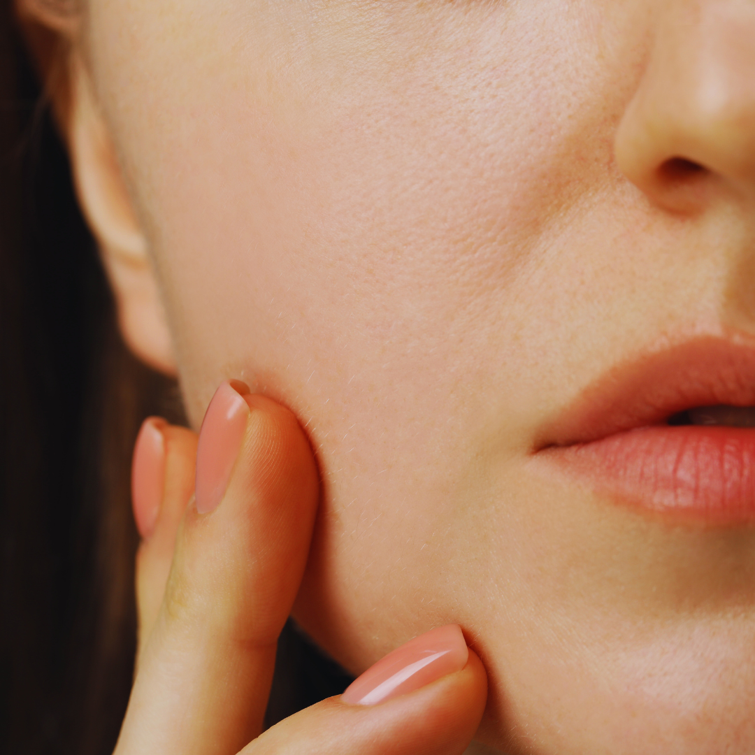 Control del estado de la piel tras peeling químico